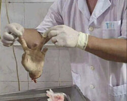 Vietnamese man lost his hand in machete attack