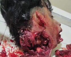 Young man mauled by huge crocodile