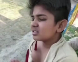 Boy accidentally got impaled on sharp metal railing