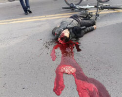 Cyclist’s brain exposed in deadly crash
