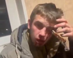 Drunk Russian woman stabbed her husband in eye