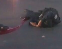 Female police officer gets her leg amputated after traffic accident