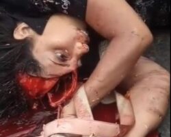 Graphic aftermath of traffic accident