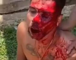 Guy got his face slashed with machete