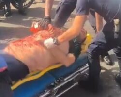 Hit by minibus while getting out of car