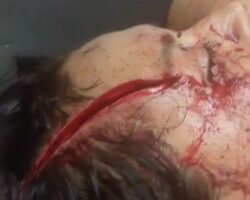 Man hacked his wife with machete