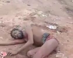 Man in agonizing shock after losing leg