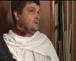 Mentally ill man severely self-mutilated