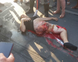 Motorcyclist left in horrific state after crashing into truck