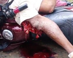 Motorcyclist seriously injured after accident