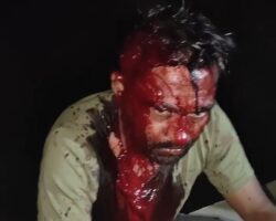 Severe head bleeding after traffic accident