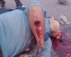 Someone shot his brain out of his head