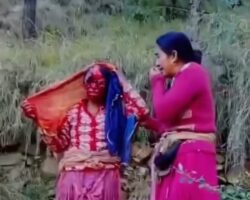 Woman’s face destroyed after bear attack