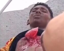 Young man with hole in his chest