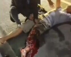 Bloody aftermath of motorcycle accident