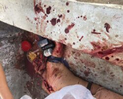 Brutally murdered by his own brother