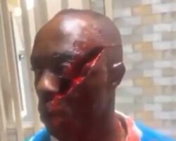 Farmer attacked with machete over land dispute