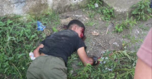 GUY suffering seizure caused by head injury from traffic accident