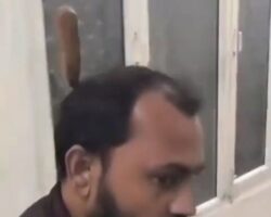 Man arrived at hospital with screwdriver lodged in his head