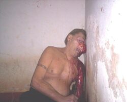 Man shot himself in head with rifle