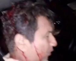 Man suffered head injury during confrontation with police