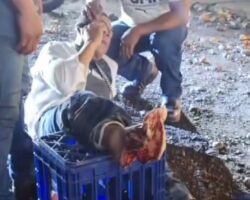 Motorcyclist suffers crushed foot in collision with truck