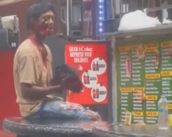 Severely injured man after machete attack