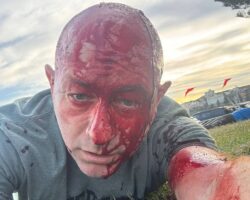 Terrorist attack on Bondi Beach in Sydney