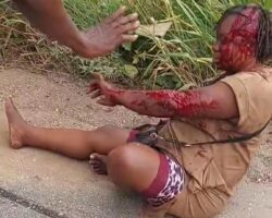 Van accident partially scalped her head