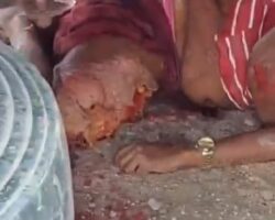 Woman has both of her legs crushed by truck