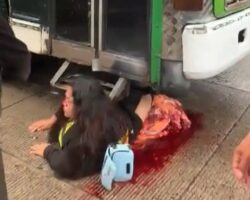 Woman’s lower body crushed by city bus