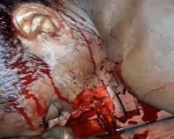 Brazilian man died in machete attack