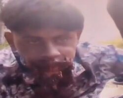 Firecracker tore his face apart