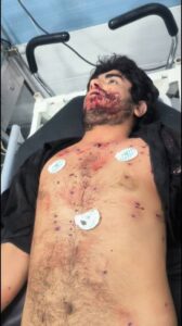 Iranian anti-government protests 1