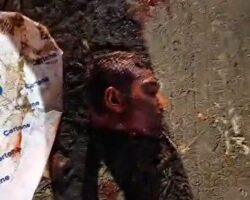 Man’s dismembered body found in plastic bags on Manaus streets