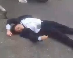 Seizure after head injury caused by motorcycle accident