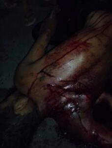 Violently attacked with machete on street