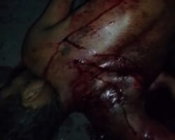 Violently attacked with machete on street