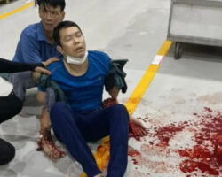 Worker forgets his hands in hydraulic machine