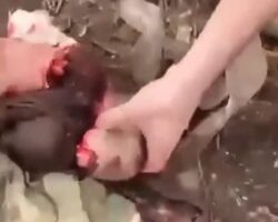 Amputation on battlefield