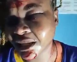 Beaten and stabbed by her evil husband