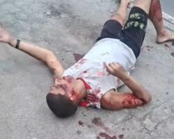 Brazilian man severely injured in motorcycle accident