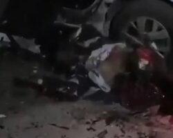 Car explosion tore off both of his legs