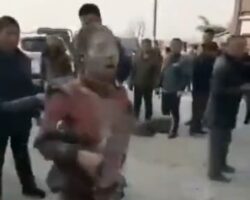 Chinese woman suffered severe burns because of her mobile phone