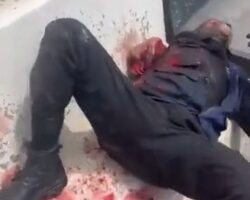 Delivery guy lost his arm in traffic accident