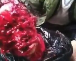 Dog ripped apart guy’s entire face