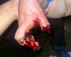 Female soccer fan loses multiple fingers after mishandling pyrotechnics