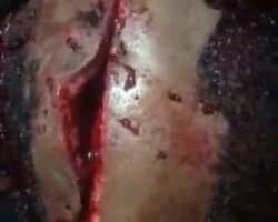 Injured member of Vikings gang after being attacked by rival