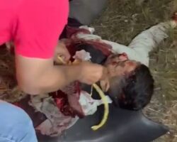 Injured motorcycle cop dying after collision with vehicle