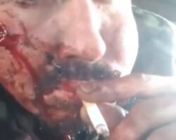 Injured soldier taking cigarette break